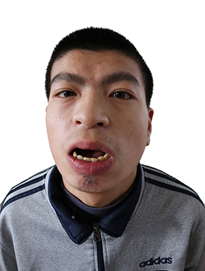 "" ""