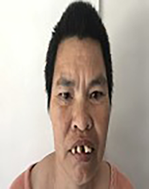 "" ""